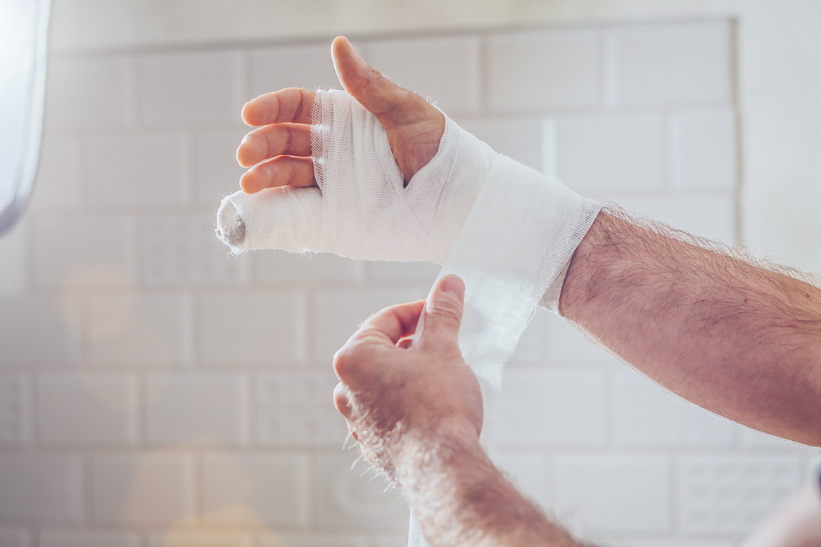 Traumatology - bandage of the injured arms